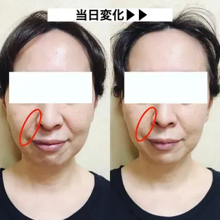 顔の歪み矯正専門 宮内翔のエステ・リラクイメージ