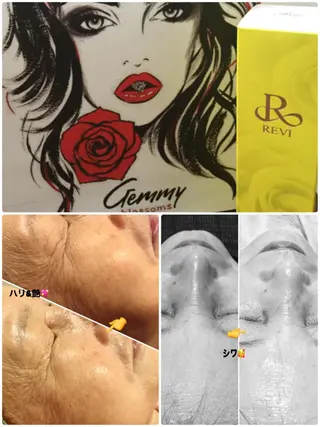 【リベルハーブピーリング認定店】敏感肌・美白脱毛専門店Dione立川店所属・Dione 立川店のエステ・リラクイメージ