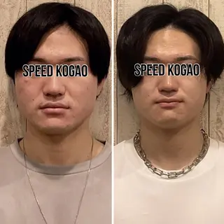 小顔矯正NAKA 筋膜/脂肪/毛穴洗浄のエステ・リラクイメージ