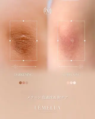 aimer所属・aimer 島田のエステ・リラクイメージ