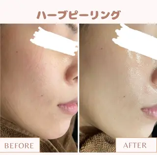 メンズ キッズ Amaryllis 🌹松本のエステ・リラクイメージ