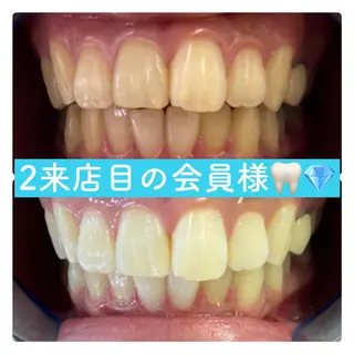 PLATINUM Beauty 横浜店所属・ホワイトニングルーム 横浜店のその他イメージ