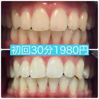 PLATINUM Beauty 横浜店所属・ホワイトニングルーム 横浜店のその他イメージ