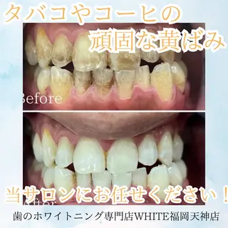メンズ ホワイトニング専門店 WHITE天神店のエステ・リラクイメージ