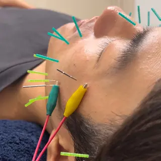 美容鍼×小顔×姿勢× ブライダル整体のエステ・リラクイメージ