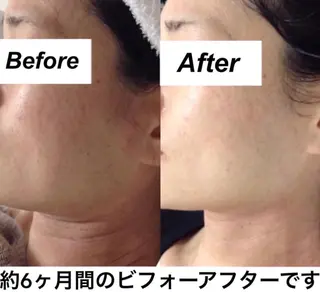 都度払い肌質改善 &脱毛Blancheのエステ・リラクイメージ