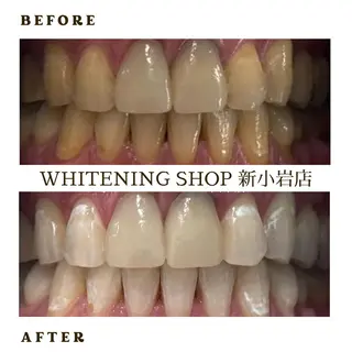 メンズ ホワイトニング ショップ新小岩店のその他イメージ