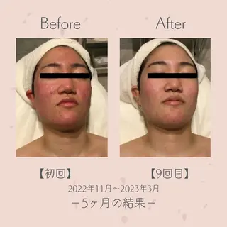 エステ＆美肌脱毛 ココサロ倉敷店のエステ・リラクイメージ