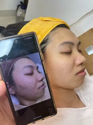 ニキビ、痩身、脱毛、 サクラチャンスパのエステ・リラクイメージ