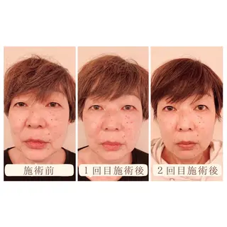 MORE BEAUTY ESTHE 本通り店所属・more 𓍯 のエステ・リラクイメージ