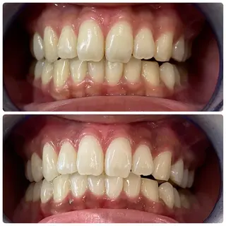 White Berry SELF BEAUTY SALON所属・セルフホワイトニング 🦷口元垢抜け✨のその他イメージ