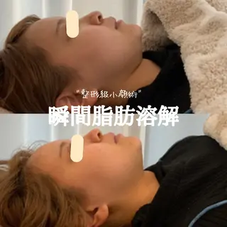 最速小顔・肌質管理 ❣️エスポワールのエステ・リラクイメージ