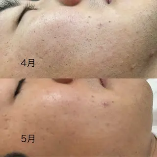 メンズ エステサロンMee. 大畑のエステ・リラクイメージ