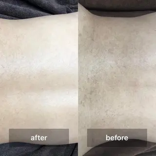 脱毛　Beauty salon Lumiere（ルミエール）所属・完全都度払い脱毛⭐︎ Lumiereのエステ・リラクイメージ