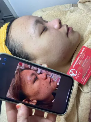 ニキビ、痩身、脱毛、 サクラチャンスパのエステ・リラクイメージ