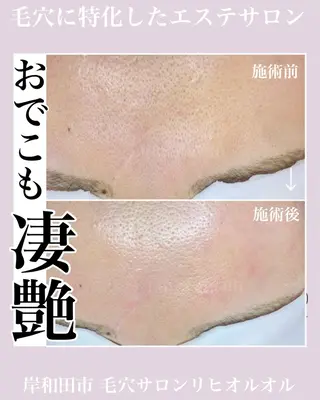 毛穴汚れ改善専門店/ 岸和田/リヒオルオルのエステ・リラクイメージ