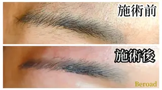 メンズ アイブロウ 脱毛＆フェイシャル　Beroad【ビロード】美道所属・脱毛＆フェイシャル Beroad  美道のエステ・リラクイメージ
