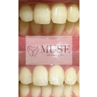 セルフホワイトニングサロンMUSE所属・セルフホワイトニング MUSE🫧焼津のその他イメージ