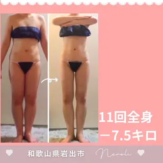 温活beautyサロンNeroli所属・切らない脂肪吸引🔥 Neroliまりこのエステ・リラクイメージ