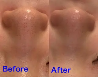 Fulala 永田のエステ・リラクイメージ