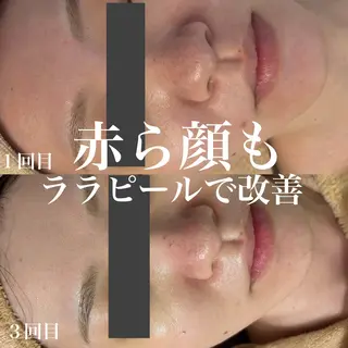 WHITE AQUA 北千住店のエステ・リラクイメージ