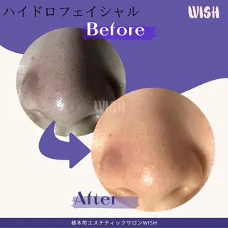 WISH 美肌脱毛のプロ！須藤のエステ・リラクイメージ