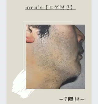 メンズ 女性専用脱毛サロン エンジェルナンバーのエステ・リラクイメージ