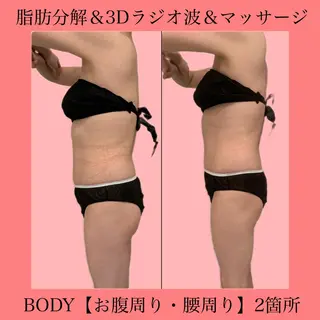 ✨美肌水光✨ アトリエリュバンのエステ・リラクイメージ