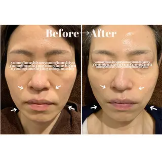 よもぎ蒸しエステサロン★yun所属・よもぎ蒸しサロン ゆんのエステ・リラクイメージ