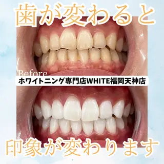 メンズ ホワイトニング専門店 WHITE天神店のエステ・リラクイメージ