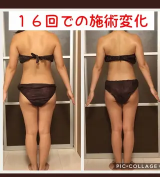 セミロング カラー パーマ ヘアアレンジ メンズ キッズ ネイル マツエク・マツパ アニメ,Vオタク× 即効痩せエステサロンのエステ・リラクイメージ