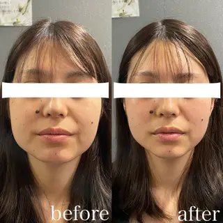 骨気&Relaxation vivian所属・VIVIAN 前田のエステ・リラクイメージ