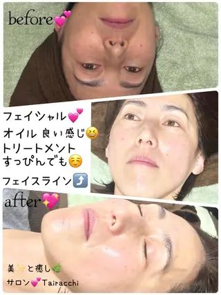 Tairacchi ﾀｲﾗｯﾁのエステ・リラクイメージ