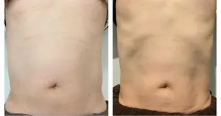 癒し腸もみサロン シャユーム　ゆきなのエステ・リラクイメージ