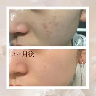 🦋美肌サロン. maho🦋のエステ・リラクイメージ