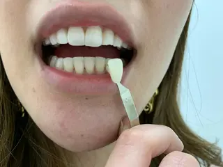 217whitening  room所属・217 ホワイトニングルームのエステ・リラクイメージ