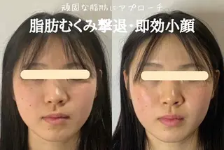 最速小顔・肌質管理 ❣️エスポワールのエステ・リラクイメージ