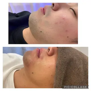 メンズ Cerise La La(スリーズララ)所属・まつ毛パーマ×脱毛 スリーズララ🌼のエステ・リラクイメージ