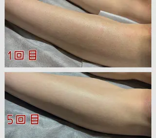 脱毛フェイシャル痩身 エリア最安👑永野舞のエステ・リラクイメージ