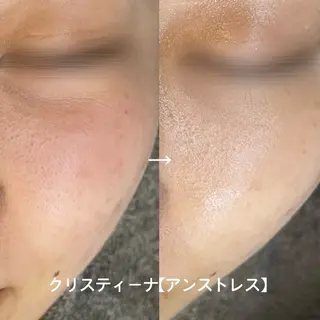 LEPUS （レプス）sasaのエステ・リラクイメージ