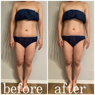 marron所属・痩身ハイパーナイフ ララピールリアボーテのエステ・リラクイメージ