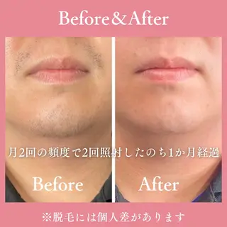 メンズ 有人型セルフサロン 脱毛/痩身/美顔のその他イメージ