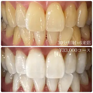 PLATINUM Beauty 横浜店所属・ホワイトニングルーム 横浜店のその他イメージ