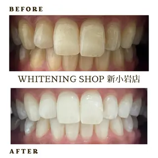 メンズ ホワイトニング ショップ新小岩店のその他イメージ