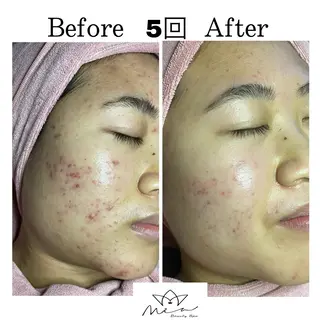 Mia beauty所属・MiA Beautyのエステ・リラクイメージ