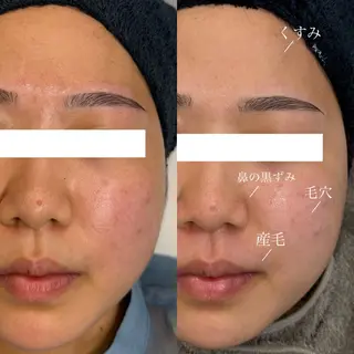 アイブロウ WHITEEYE堺東 店長/藁粥　明の眉毛・アイブロウイメージ