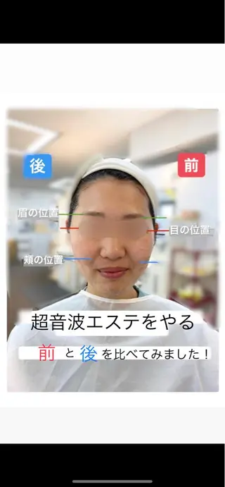 ナリス ビューティステーション DeI'm所属・DeI'mあべの 桶本瑞季のエステ・リラクイメージ