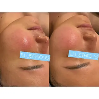 ☆痩身/小顔☆ 結果出します☆のエステ・リラクイメージ