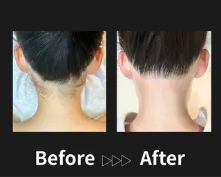 脱毛サロン&ドライヘッドスパFIS 溝の口店所属・脱毛サロン FIS　溝の口店のエステ・リラクイメージ