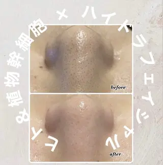 ENCHANT Kaede/肌質改善のその他イメージ